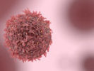 Lutte contre le #cancer : vers une #radiothérapie de grande précision #esante #hcsmeufr #IA  | autour du CANCER | Scoop.it