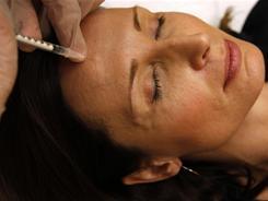 Botox Might Make You Less Empathetic. So What? | Empathy Movement Magazine | Scoop.it