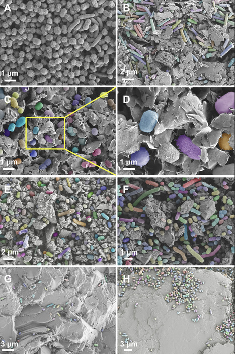 Mineral substrates as evolutionary drivers of soil microbial diversity through the rare biosphere | mSph | RMH | Scoop.it