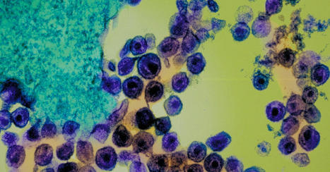 A Bold Effort to Finally Cure HIV — Using CRISPR | Amazing Science | Scoop.it