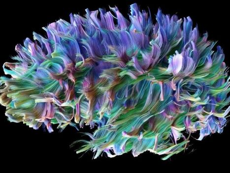 Des images exceptionnelles des fibres nerveuses du cerveau | Médecine  Cerveau Intelligence | Scoop.it