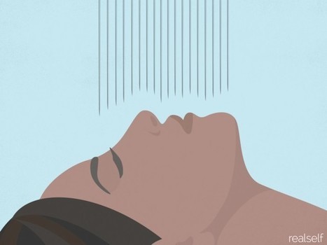 Are Microneedles the New Lasers? Doctors Talk About the Next Big Aesthetic Trend | Intra-Dermal drug delivery: Opportunities and Challenges? | Scoop.it