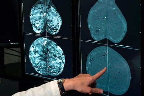 3 minutes of vigorous activity may cut risk of 13 cancers, study finds | Hospitals and Healthcare | Scoop.it