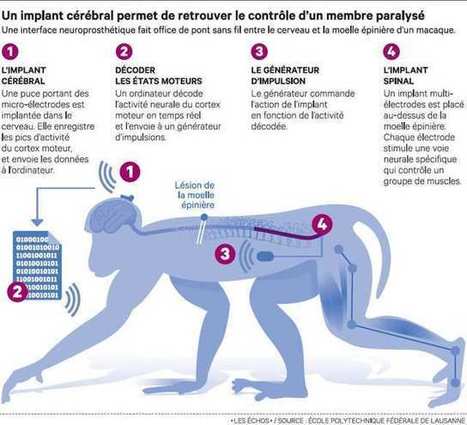 Sciences: une neuroprothèse contre la paralysie | 16s3d: Bestioles, opinions & pétitions | Scoop.it