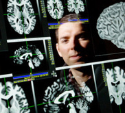 Crean un mapa de la inteligencia emocional en el cerebro | Edumorfosis.it | Scoop.it