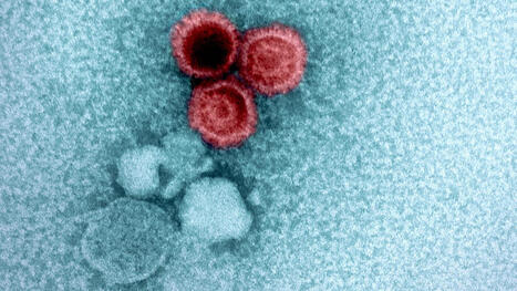 The Quest to Eradicate Multiple Sclerosis with Epstein-Barr Virus (EBV) Vaccine | Scl&eacute;rose en Plaques | Scoop.it