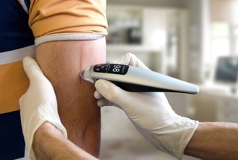 L'avenir de la suture : impression 3D de peau par fusion réalisable en 2030 ? | Veille sur les technologies d'impression 3D | Scoop.it