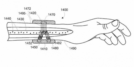 VIDEO. Google dépose un brevet pour son bracelet anti-cancer | Chair et Métal - L'Humanité augmentée | Scoop.it