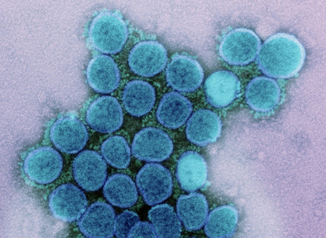 WHO Adds NB.1.8.1 as SARS-CoV-2 Variant Under Monitoring -  CIDRAP | Virus World | Scoop.it