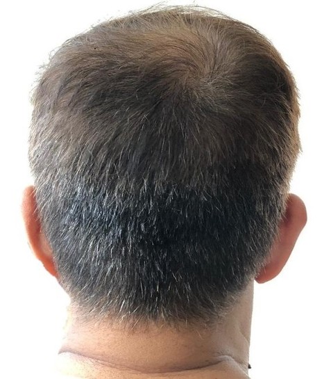 Men S Haircut For Thinning Crown Treat Hair L
