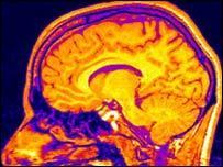 La neurociencias esta cambiando el paradigma educativo | NeuroPsicoEducación al Día | Scoop.it