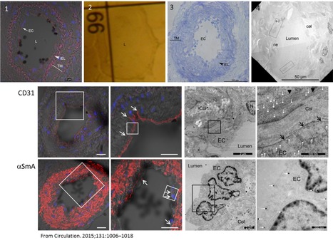 FOCUS PLATEFORME : Mise au point d’une méthode originale et simplifiée de microscopie corrélative dans le cadre de l’hypertension artérielle pulmonaire : une collaboration fructueuse entre deux pla... | Life Sciences Université Paris-Saclay | Scoop.it