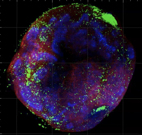 Vers un modèle plus proche de la réalité pour comprendre le développement du cerveau | Life Sciences Université Paris-Saclay | Scoop.it