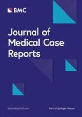 Seronegative limbic encephalitis manifesting as subacute amnestic syndrome: a case report and review of the literature | Journal of Medical Case Reports | Full Text | AntiNMDA | Scoop.it