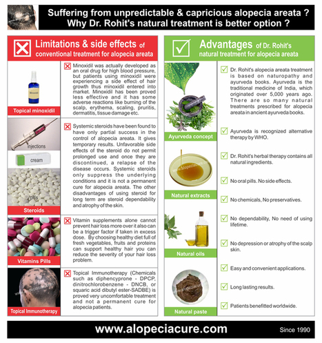 Alopecia Hair Loss Treatment Alopeciacure B