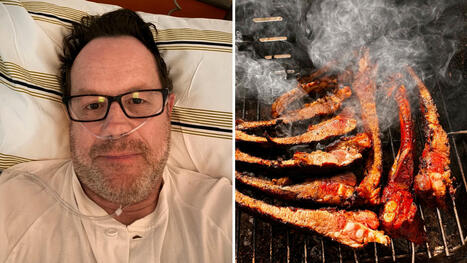 Grillade revbensspjäll – hamnade på akuten | 1Uutiset - Lukemisen tähden | Scoop.it