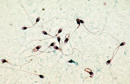 La vasectomie est la méthode de contraception la plus efficace. | Famille et sexualité | Scoop.it