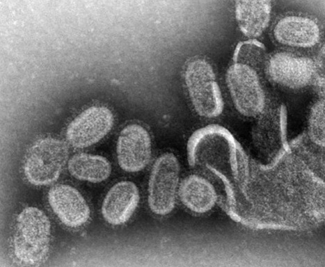 Novel Molecular Method Detects Any Enveloped Viruses in Minutes Using Nonspecific DNA | Virus World | Scoop.it