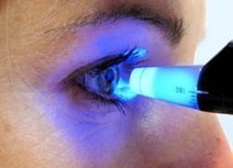 Presión ocular elevada y glaucoma | Salud Visual 2.0 | Scoop.it