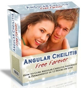 Angular Cheilitis Free Forever Jason White PDF Free Download | Ebooks & Books (PDF Free Download) | Scoop.it
