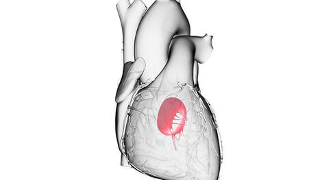 New Valves Treat ‘No-Option’ Heart Patients | Transcatheter Treatment of Mitral Regurgitation | Scoop.it