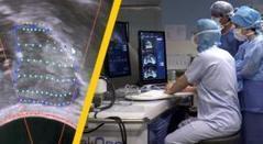 #Depistage du #Cancer de la #Prostate : avec le #Robot Apollo, le geste se précise #Medecine augmentée - Vidéo du QuotidienMedecin @leQdM ‏& Koelis @KoelisBx ‏ #Esante #hcsmeufr #Medtech  | autour du CANCER | Scoop.it