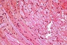 Découverte du mécanisme de la surdité suite au bruit | Revue de presse Implant Cochléaire | Scoop.it