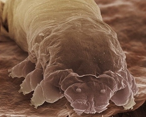 Voici Demodex folliculorum, il crapahute sur votre visage et ses excréments provoqueraient la couperose | EntomoNews | Scoop.it