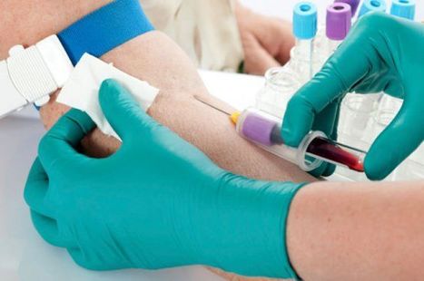 D&eacute;pistage et prise en charge des IST :&nbsp;extension des missions des CeGIDD | sida | Scoop.it