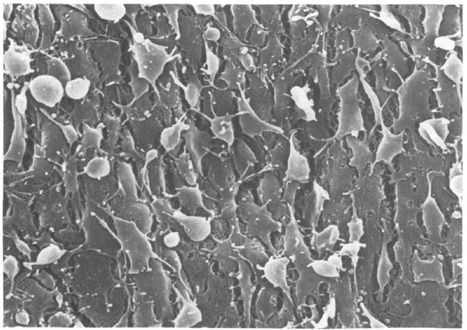Inhibition of endothelial cell regrowth. Cessation of aortic endothelial cell replication after balloon catheter denudation. | Interventional Cardiology | Scoop.it