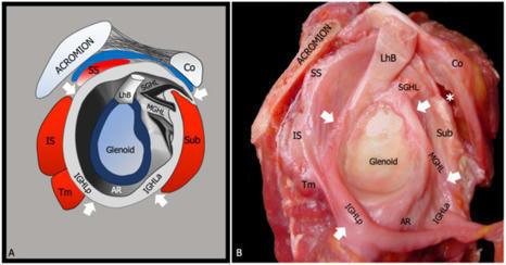 Diagnostics | Free Full-Text | Adhesive Capsulitis of the Shoulder: Current Concepts on the Diagnostic Work-Up and Evidence-Based Protocol for Radiological Evaluation | Rheumatology-Rhumatologie | Scoop.it