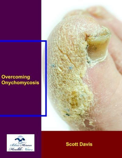 Scott Davis' Overcoming Onychomycosis (PDF Book Download) | Ebooks & Books (PDF Free Download) | Scoop.it