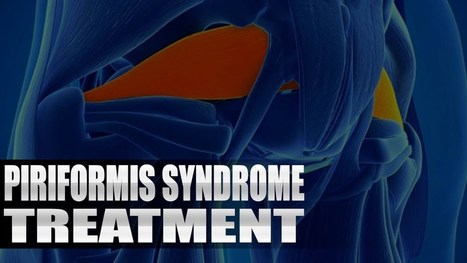 Piriformis Syndrome Treatment Chiropractor | El Paso, TX. | Video | Sciatica "The Scourge & The Treatments" | Scoop.it