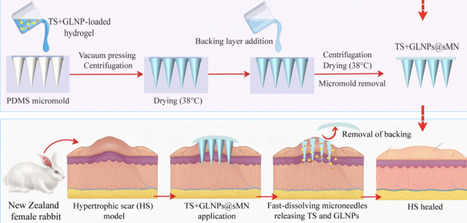 Fast-Dissolving Sodium Alginate-Based Microneedle Patch Integrating Tranilast and Glabridin-Loaded Nanoparticles for Dual-Action Hypertrophic Scar Therapy | Intra-Dermal drug delivery: Opportunities and Challenges? | Scoop.it