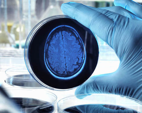 Lifestyle links to dementia unknown to most people | In the news: data in the UK Data Service collection across the web | Scoop.it