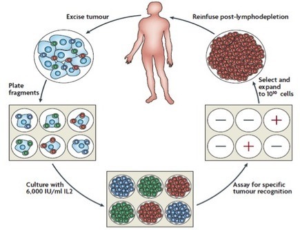 Tumor Infiltrating Lymphocytes (TIL) : Lion Biotechnologies | Immunology and Biotherapies | Scoop.it