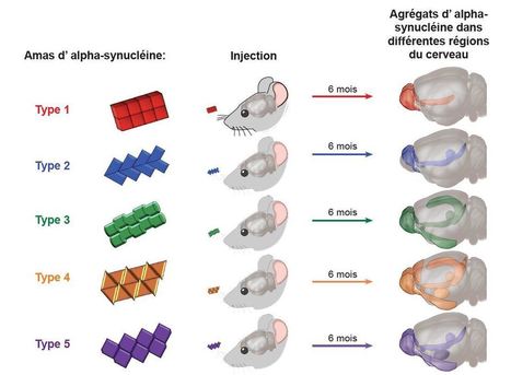 Les synucléinopathies : des maladies à géométrie variable | Life Sciences Université Paris-Saclay | Scoop.it