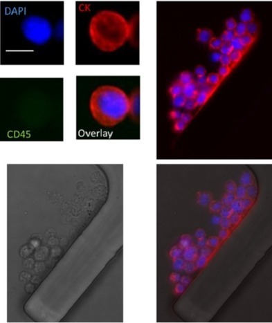 New MEMS is the first to capture and classify CTC's by phenotype. | from Flow Cytometry to Cytomics | Scoop.it