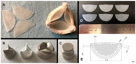 Early Feasibility Study of a Hybrid Tissue-Engineered Mitral Valve in an Ovine Model | Transcatheter Treatment of Mitral Regurgitation | Scoop.it