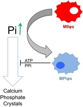 Novel phosphate-activated macrophages prevent ectopic calcification by increasing extracellular ATP and pyrophosphate | Rheumatology-Rhumatologie | Scoop.it