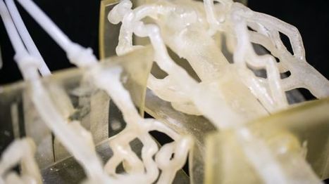 3D printing helps surgeons plan life-saving operation | Medicine | 21st Century Innovative Technologies and Developments as also discoveries, curiosity ( insolite)... | Scoop.it