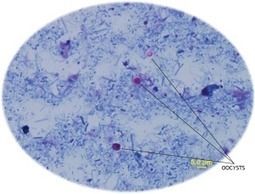 Parasitology_ Illustrated Blog | AN OPEN FORUM FOR WHAT'S NEW AND RELEVANT IN PARASITOLOGY | Immunopathology & Immunotherapy | Scoop.it