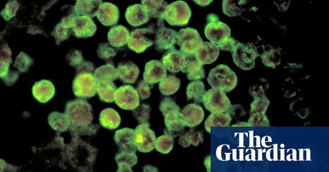 Georgia resident dies from rare ‘brain-eating amoeba | Georgia | The Guardian | World Science Environment Nature News | Scoop.it