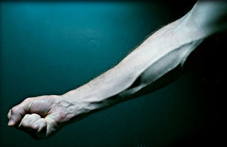 Arteries harvested from forearms are a safe heart bypass option - research | Hospitals and Healthcare | Scoop.it