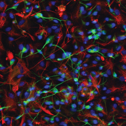 Scientists Tie DNA Repair to Key Cell Signaling Network - Bioscience Technology | Complex Insight  - Understanding our world | Scoop.it