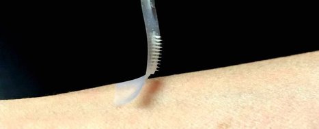 Scientists have created a painless patch that can control diabetes without injections | Intra-Dermal drug delivery: Opportunities and Challenges? | Scoop.it