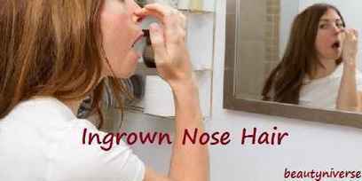 Recurring Ingrown Nose Hair In Beauty Niverse Scoop It