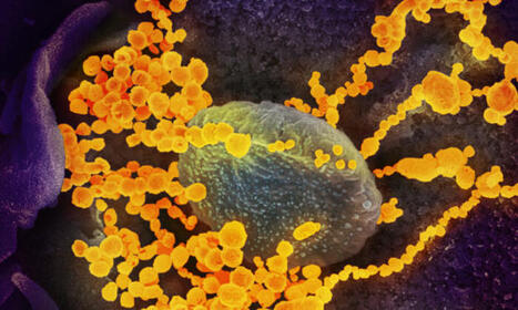 CDC Figures Show COVID at ‘Very High’ Levels in 7 US States | Covid Report | Scoop.it