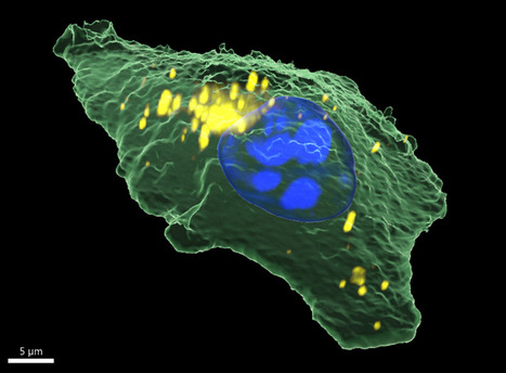 Confocal Raman Imaging and Correlative Techniques in Life Science | Innovating to what's next... | Scoop.it