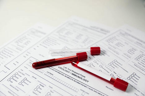 How Blood Tests Help Identify the Cause of Back Pain | Call: 915-850-0900 or 915-412-6677 | Accidents and Injuries | Scoop.it
